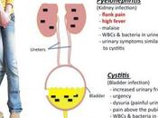 UTI, Most Common Bacterial Infection, Increasingly Resistant Oral Antibiotics