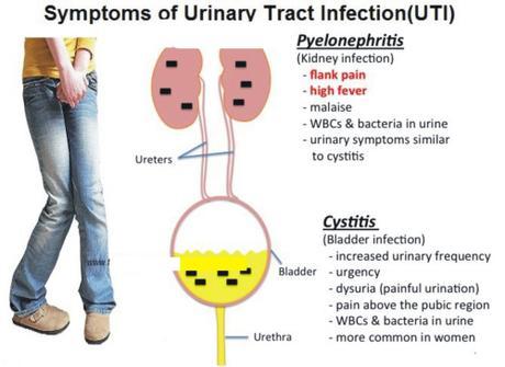 symptoms of UTI