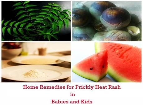 Get Rid of Prickly Heat Rash Once and For All