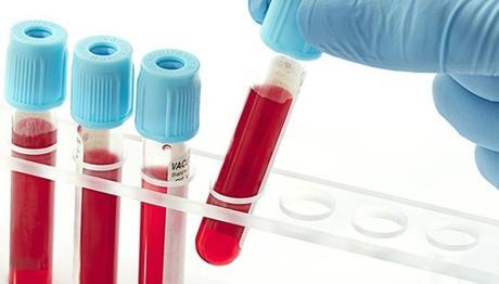 First Synthetic Blood Transfusion Set for 2017 blood-test