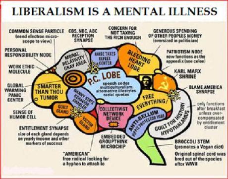 brain of the left