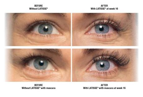 Beauty Secret: Latisse increases volume of your eyelashes, making Maybelline's impact even more breathtaking