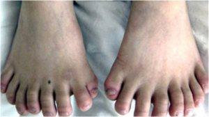 child born with 16 toes