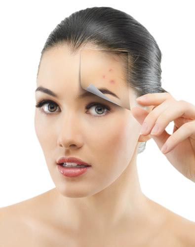 how-to-get-scar-free-skin-with-right-acne-treatment