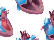 Types Heart Surgery Things Should Know