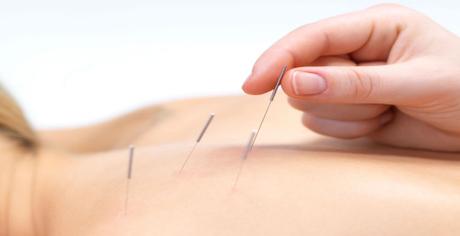 Acupuncture and Male Fertility in Dublin