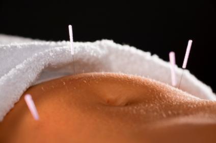 Acupuncture Can Increase IVF Success Rate