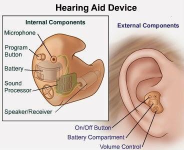 Noise Control Features of Advanced Hearing Aids in Bulleen