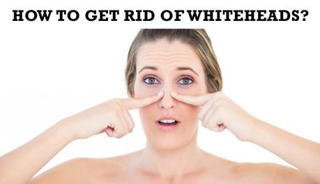  get rid of Whiteheads, acne, baking soda treatment, baking soda scrub, whiteheads home remedy