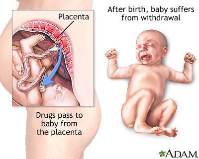 Interview with a Baby (Neonate): Q