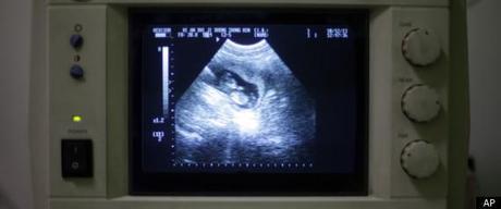 Mandatory Ultrasound