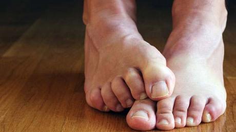 Restless Legs Syndrome Symptoms