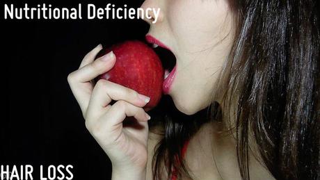 Nutritional Deficiency Hair Loss