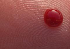 HbA1c: Biomarker of Health