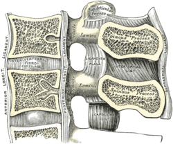 Friday Q&A: OPLL (Ossification of the Posterior Longitudinal Ligament)