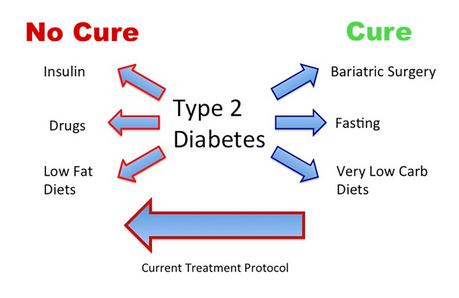 Treatments That Cure Type 2 Diabetes