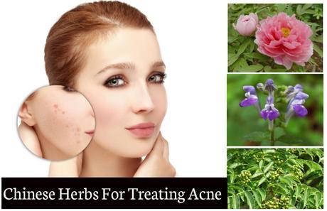 Chinese Herbs For Treating Acne