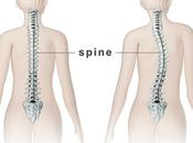 Study Shows Chiropractic Effective Adult Scoliosis Patients