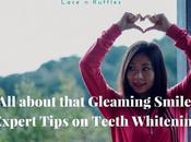 About That Gleaming Smile: Expert Tips Professional Teeth Whitening