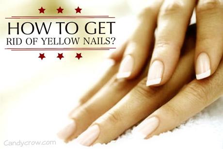 How to Get Rid of Yellow Nails Quickly? - Paperblog