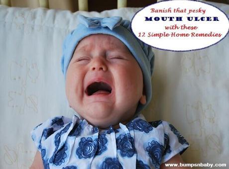 12 Home Remedies for Mouth Ulcer in Babies and Kids