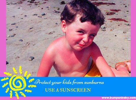 Sunscreen for Babies and Kids – Is it Really Required?