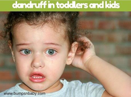 How to Get Rid of Dandruff in Kids?