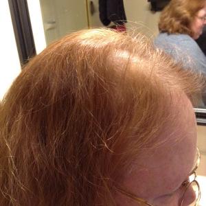 Hair Loss? Enter In RevivHair Stimulating Serum