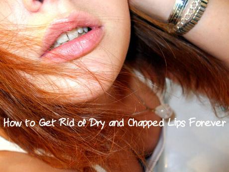 Get Rid Chapped Lips