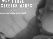 Love Stretch Marks