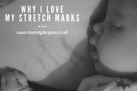 Why I love my stretch marks