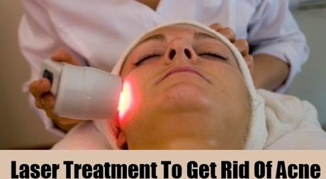Acne Laser Therapy