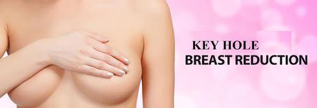 Key Hole Breast Reduction in India