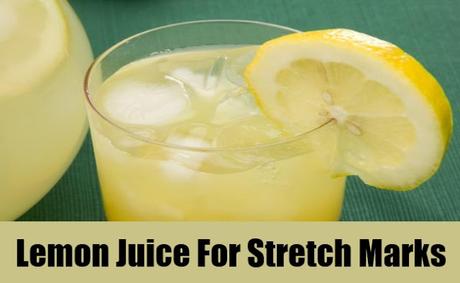 Lemon Juice for Stretch marks