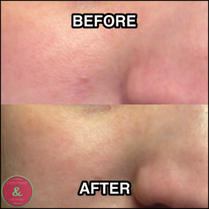 NEW PRODUCT REVIEW!!! (STRIVECTIN)