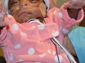 Parents Preemie Born Weighing Under Pound Celebrate Survival