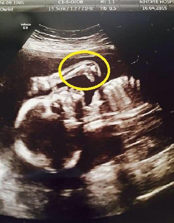 dinosaur in ultrasound