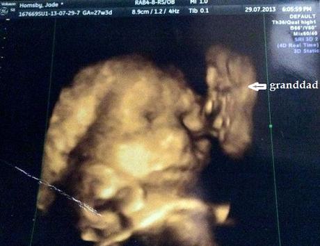 ultrasound of granddad kissing baby
