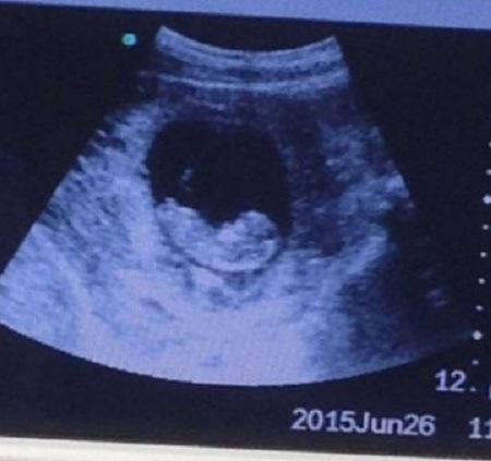 demon in womb ultrasound