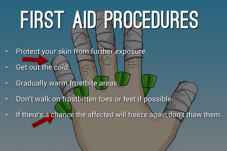 First-Aid Frostbite