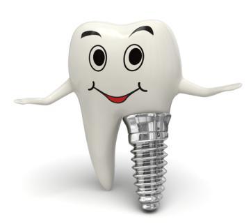 9-Benefits-Of-Dental-Implants