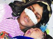 Cuts Wife’s Nose When Protested Decision Marry Child