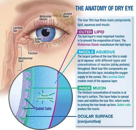 what causes dry eyes