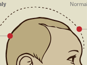 Declares Zika Situation Global Medical Emergency: Pro-Lifers? Response?