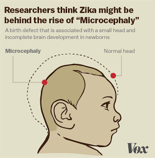 WHO Declares Zika Situation Global Medical Emergency: Pro-Lifers? Any Response?