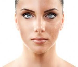 Cosmetic Procedures without Going under the Knife Cosmetic Procedures without Going under the Knife