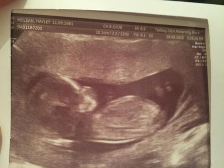 38 Week (possibly final?)  Bump Update + COMPETITION!