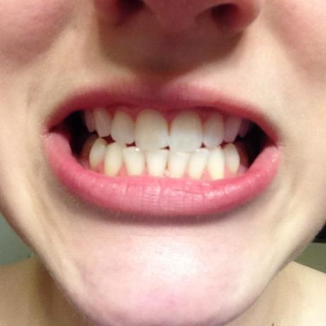 GIMMICK OR WINNER: Black Toothpaste