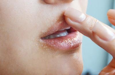 DIY Lip Exfoliation Scrub