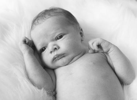 2 weeks post partum c section